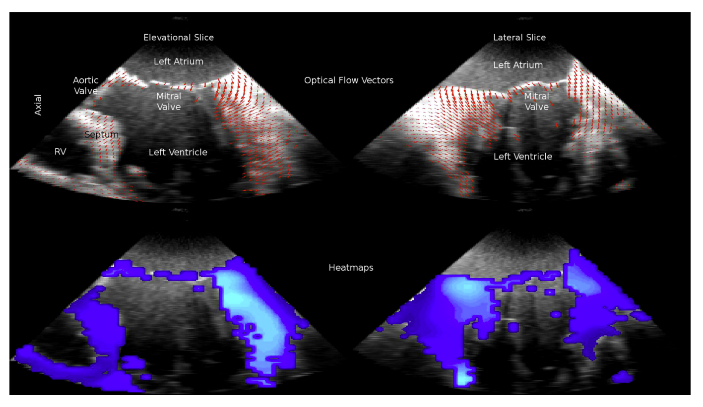 Preview for Extension of Brox optical flow to 3D ultrasound